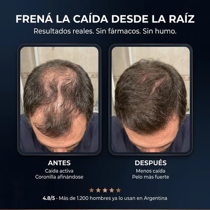 Shampoo Anti-Caída · Activador de Raíces