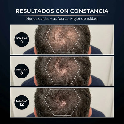 Shampoo Anti-Caída · Activador de Raíces