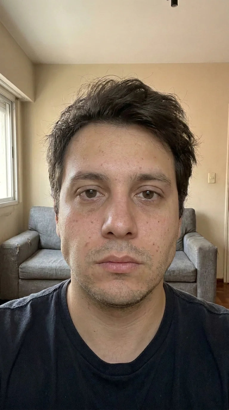 Después